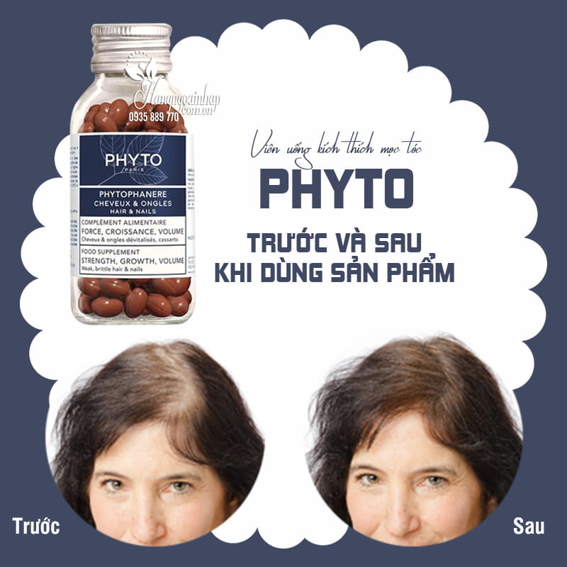 Viên uống phyto kích thích mọc tóc móng của pháp giá tốt